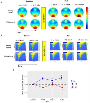 Impaired Potentiation of Theta Oscillations During a Visual Cortical Plasticity Paradigm in Individuals With Schizophrenia
